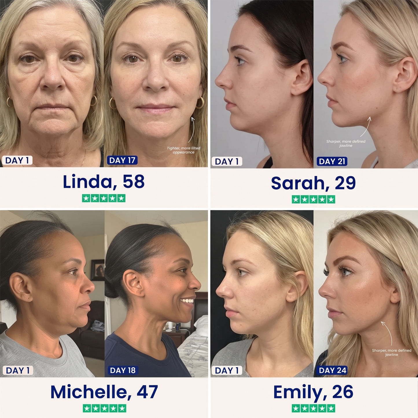 The Louvae Lift™ - Collagen Chin Lift Mask